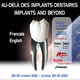 Implants